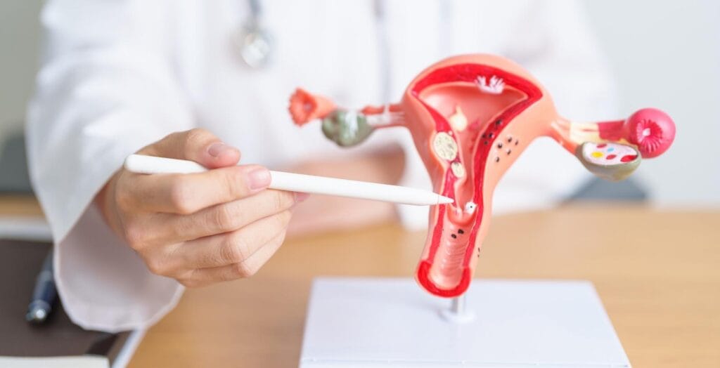 Pcos And Endometriosis: Understanding And The Support Women Deserve 6 Pcos And Endometriosis: Understanding And The Support Women Deserve