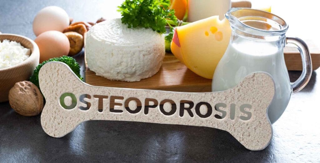 Bone Health For Women: Preventing Osteoporosis Early 7 Bone Health For Women